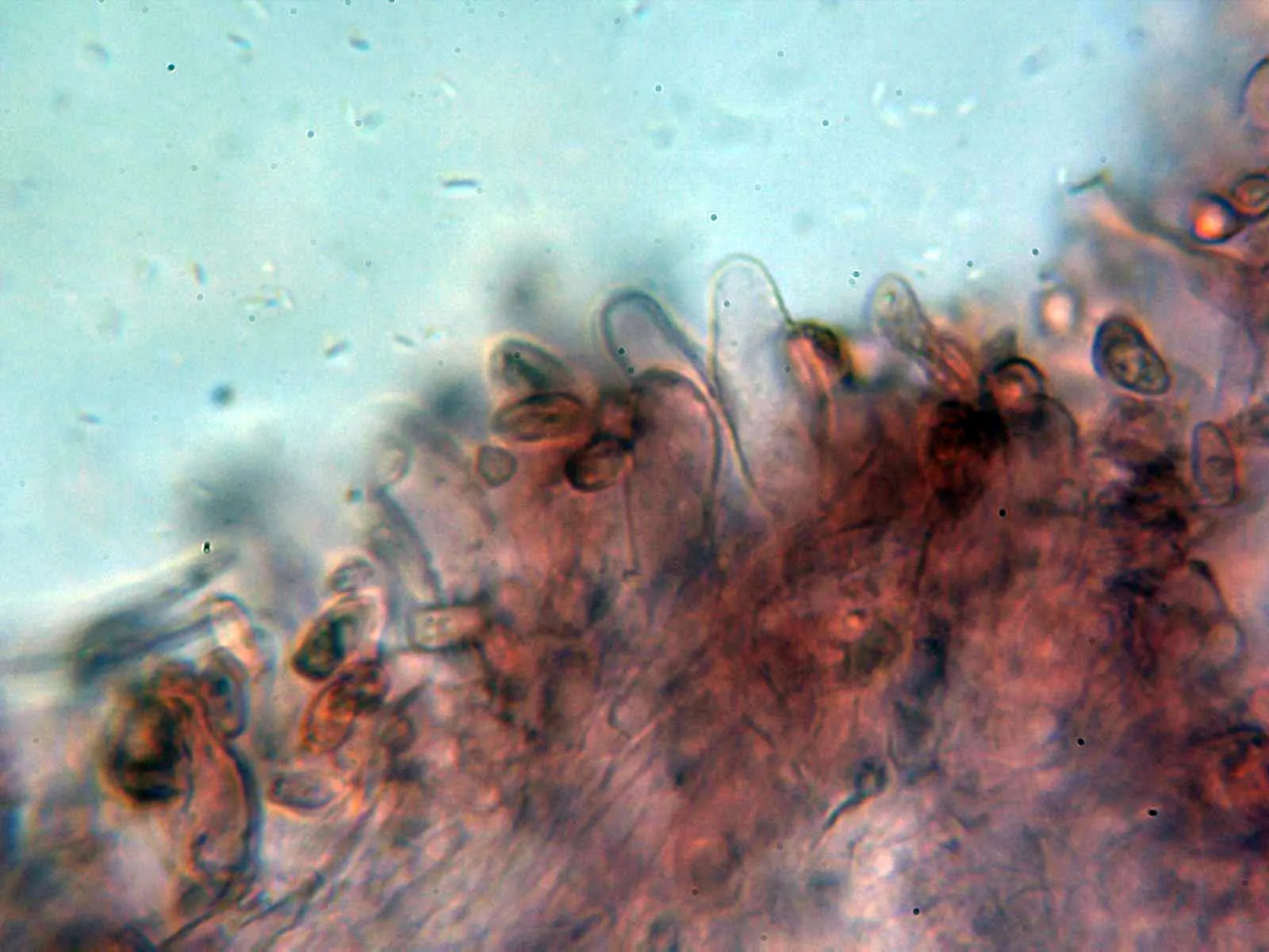 Microscopía de Lepiota xanthophylla - 10 - Queilocistidios 1